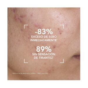 Bioderma Sebium Gel Limpiador Facial Moussant P. Mixta A Grasa 200 ml - Imagen 3